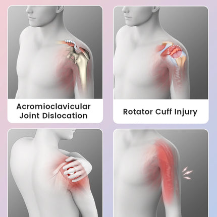 VELPEAU Arm Sling for Elbow Injury, Forearm Fracture, Broken Shoulder, Breathable and Soft Shoulder Immobilizer Fits Both Arms