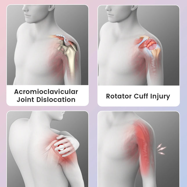 VELPEAU Arm Sling for Elbow Injury, Forearm Fracture, Broken Shoulder, Breathable and Soft Shoulder Immobilizer Fits Both Arms