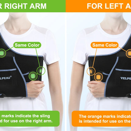 VELPEAU Arm Sling for Elbow Injury, Forearm Fracture, Broken Shoulder, Breathable and Soft Shoulder Immobilizer Fits Both Arms